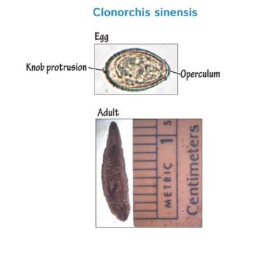  Clonorchis Sinensis: A Tiny Trematode That Thrives In Your Bile Ducts!