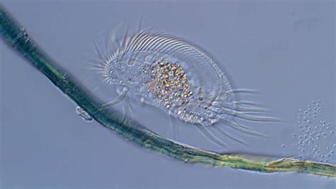  Wallaby Ciliate: An Exquisite Wanderer In A Microscopic World!