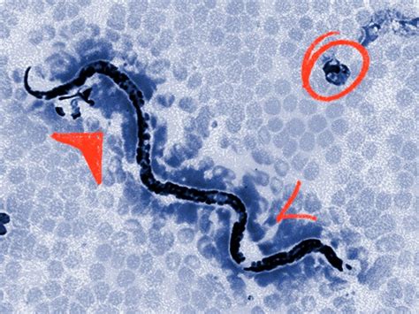  Microsporidium: Unlocking the Secrets of Tiny Parasitic Invaders That Can Cause Infections In a Variety of Animals!