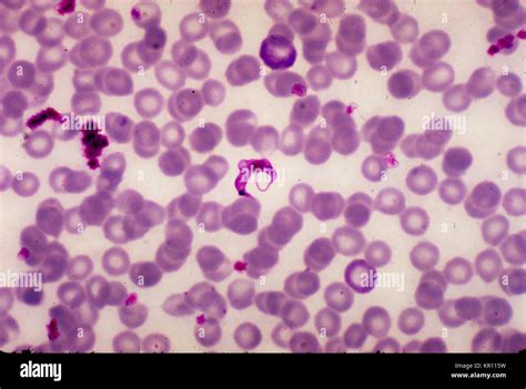  Trypanosoma: A Microscopic Vampire Lurking in Your Bloodstream!